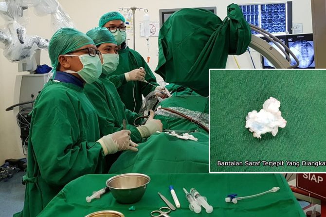 Alhamdulillah, Tim Medis RSUD AA Berhasil Lakukan Operasi Saraf Terjepit Tulang Punggung