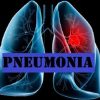 Dari RSUD Arifin Achmad: Waspadai Pneumonia atau Paru-paru Basah pada Anak