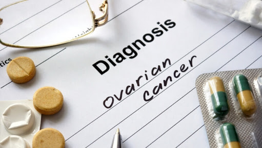 Dari RSUD Arifin Achmad: Mendiagnosa Kanker Ovarium Hanya Lewat Operasi