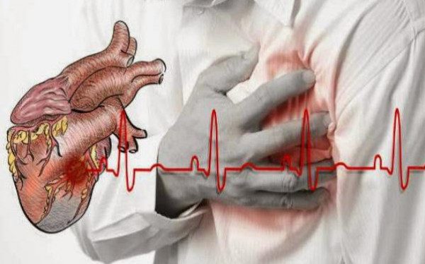 Dari RSUD Arifin Achmad: Penyakit Katup Jantung, Gejala dan Penanganan