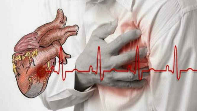 Dari RSUD Arifin Achmad: Penyakit Katup Jantung, Gejala dan Penanganan